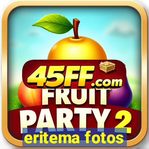 eritema fotos